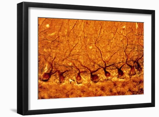 LM of Purkinje Nerves Cells In the Cerebe-Volker Steger-Framed Photographic Print