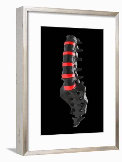 Lumbar Spine And Sacrum, Artwork-Laguna Design-Framed Photographic Print