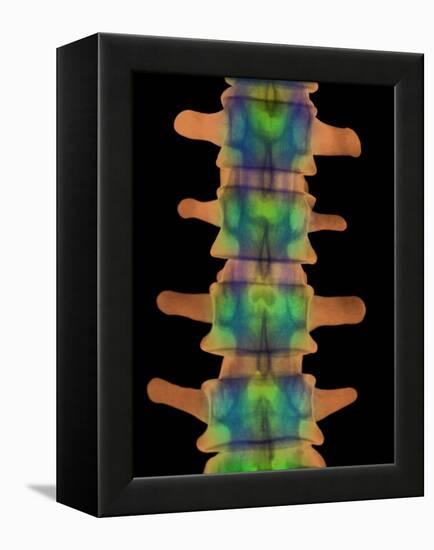 Lumbar Spine, X-ray-Science Photo Library-Framed Premier Image Canvas