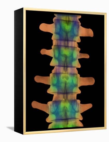 Lumbar Spine, X-ray-Science Photo Library-Framed Premier Image Canvas