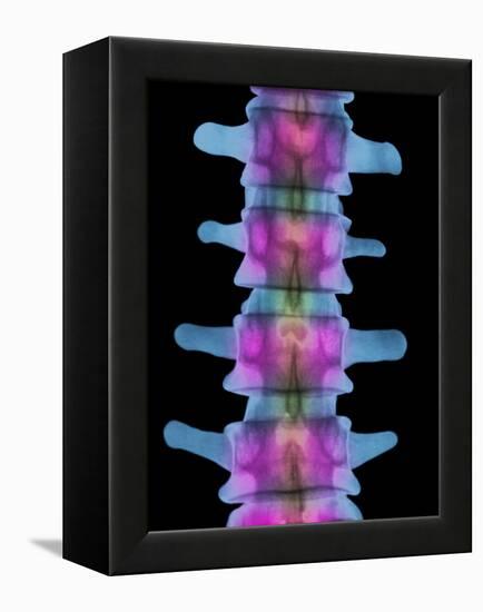 Lumbar Spine, X-ray-Science Photo Library-Framed Premier Image Canvas