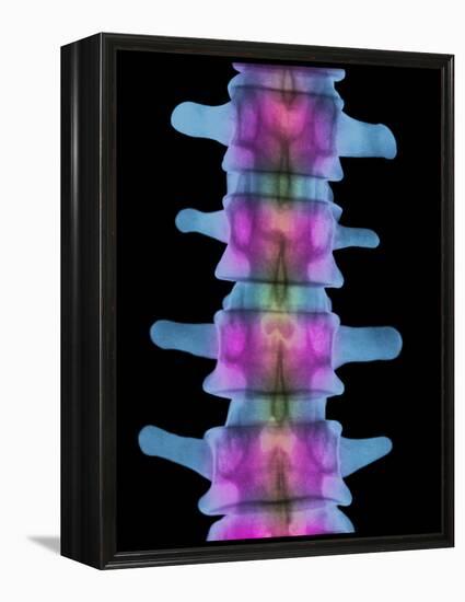 Lumbar Spine, X-ray-Science Photo Library-Framed Premier Image Canvas