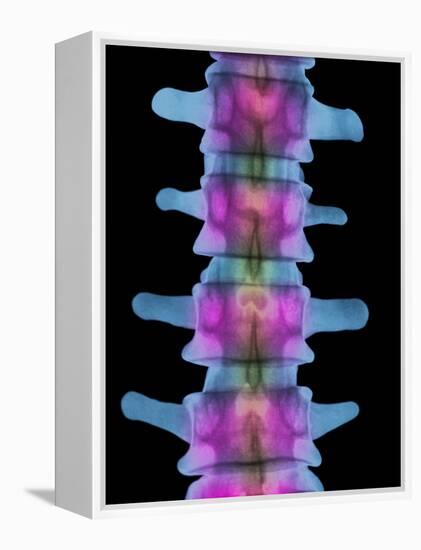 Lumbar Spine, X-ray-Science Photo Library-Framed Premier Image Canvas