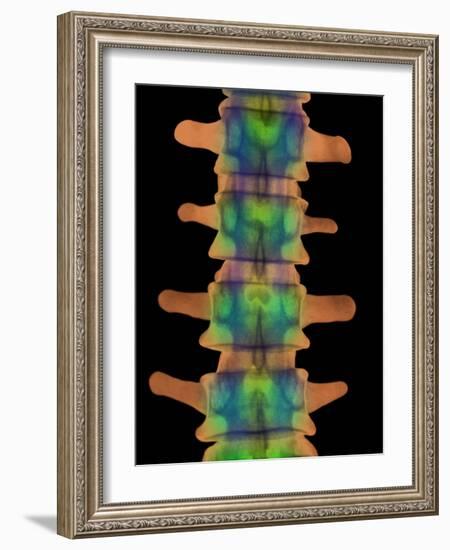 Lumbar Spine, X-ray-Science Photo Library-Framed Photographic Print