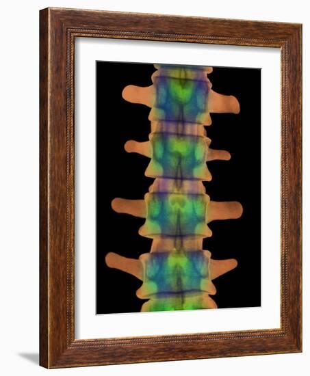 Lumbar Spine, X-ray-Science Photo Library-Framed Photographic Print