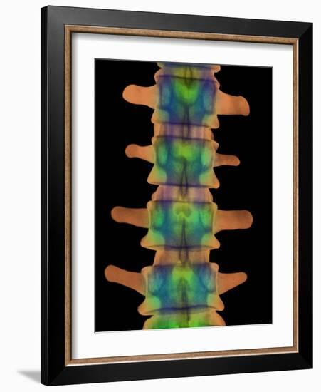 Lumbar Spine, X-ray-Science Photo Library-Framed Photographic Print