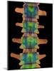 Lumbar Spine, X-ray-Science Photo Library-Mounted Photographic Print