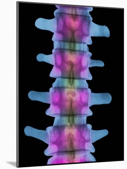 Lumbar Spine, X-ray-Science Photo Library-Mounted Photographic Print