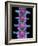 Lumbar Spine, X-ray-Science Photo Library-Framed Photographic Print