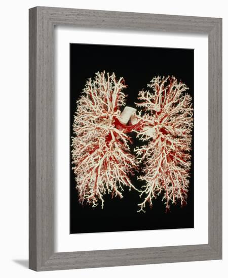 Lung Airways-Science Photo Library-Framed Photographic Print