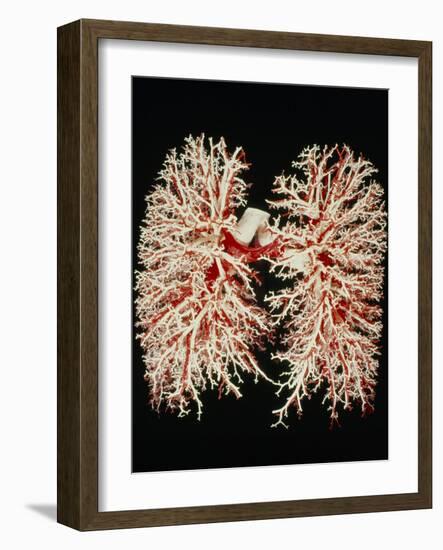 Lung Airways-Science Photo Library-Framed Photographic Print