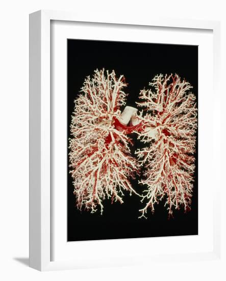 Lung Airways-Science Photo Library-Framed Photographic Print