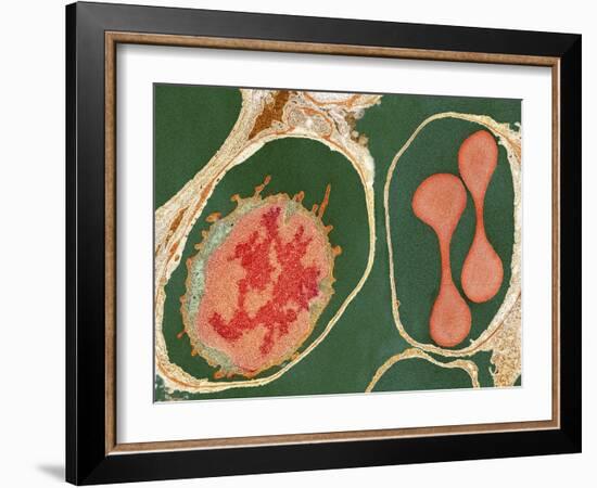 Lung Alveoli And Blood Cells, TEM-Thomas Deerinck-Framed Photographic Print