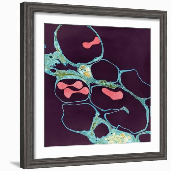 Lung Alveoli And Red Blood Cells, TEM-Thomas Deerinck-Framed Premium Photographic Print