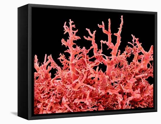 Lung Blood Vessels, SEM-Susumu Nishinaga-Framed Premier Image Canvas