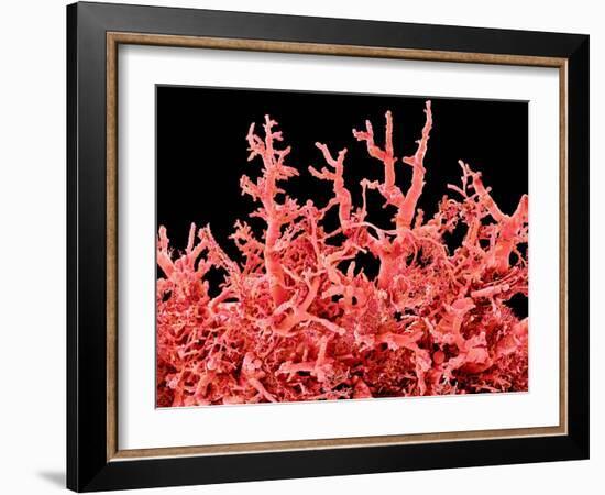 Lung Blood Vessels, SEM-Susumu Nishinaga-Framed Photographic Print