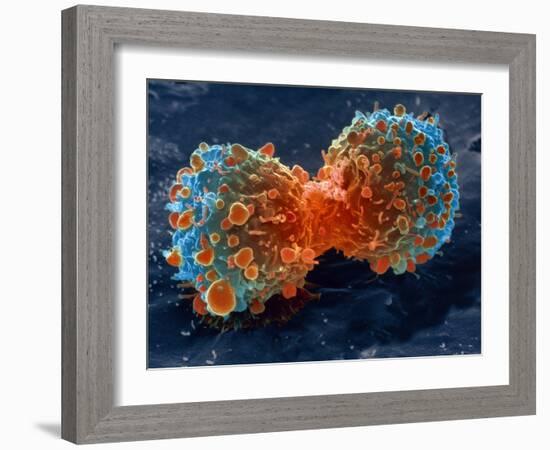 Lung Cancer Cell Division, SEM-Steve Gschmeissner-Framed Photographic Print