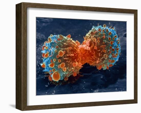 Lung Cancer Cell Division, SEM-Steve Gschmeissner-Framed Photographic Print