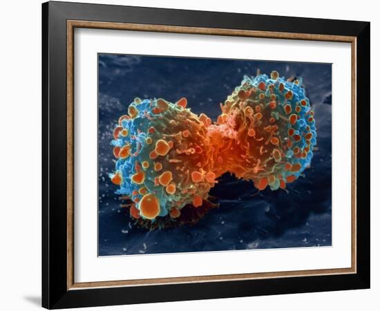 Lung Cancer Cell Division, SEM-Steve Gschmeissner-Framed Photographic Print