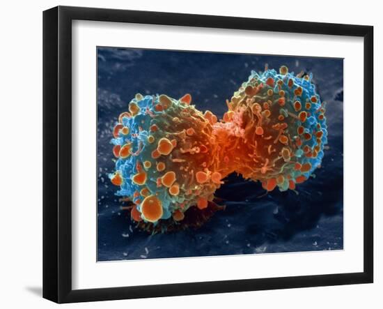 Lung Cancer Cell Division, SEM-Steve Gschmeissner-Framed Photographic Print