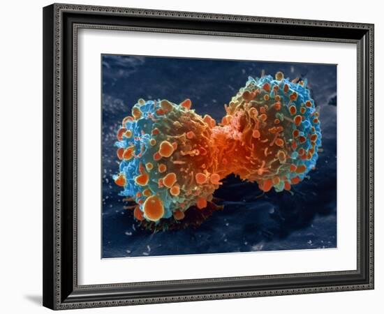 Lung Cancer Cell Division, SEM-Steve Gschmeissner-Framed Photographic Print