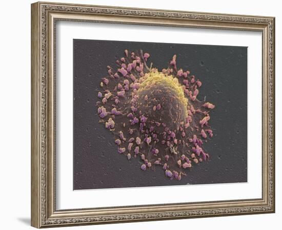 Lung Cancer Cell, SEM-Steve Gschmeissner-Framed Photographic Print