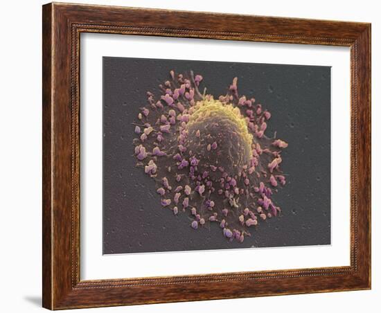 Lung Cancer Cell, SEM-Steve Gschmeissner-Framed Photographic Print