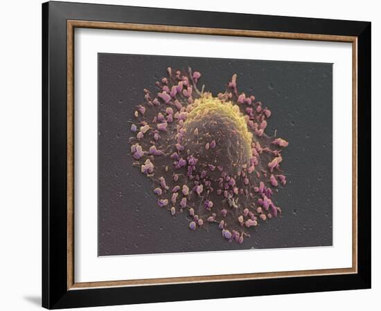 Lung Cancer Cell, SEM-Steve Gschmeissner-Framed Photographic Print