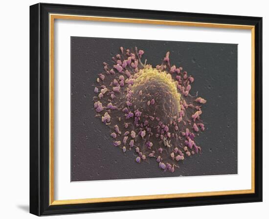 Lung Cancer Cell, SEM-Steve Gschmeissner-Framed Photographic Print