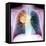 Lung Cancer, X-ray-Du Cane Medical-Framed Premier Image Canvas