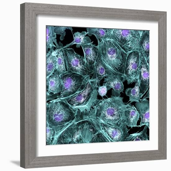 Lung Cells, Fluorescent Micrograph-Dr. Torsten Wittmann-Framed Premium Photographic Print