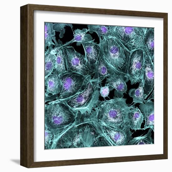 Lung Cells, Fluorescent Micrograph-Dr. Torsten Wittmann-Framed Premium Photographic Print