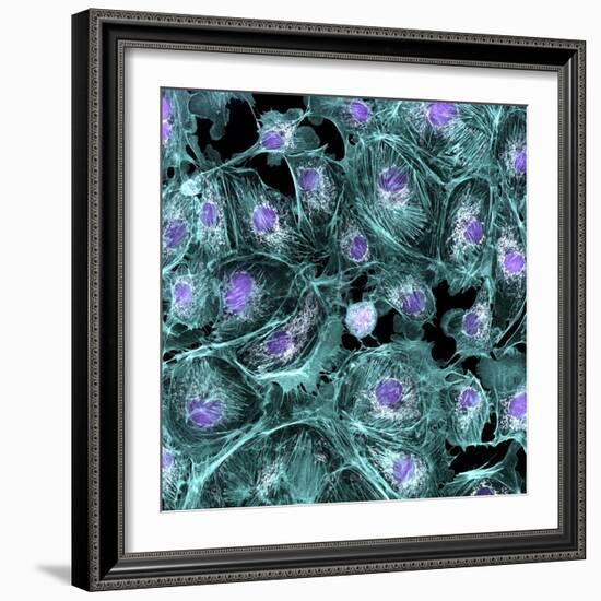 Lung Cells, Fluorescent Micrograph-Dr. Torsten Wittmann-Framed Premium Photographic Print