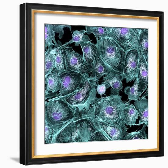 Lung Cells, Fluorescent Micrograph-Dr. Torsten Wittmann-Framed Premium Photographic Print