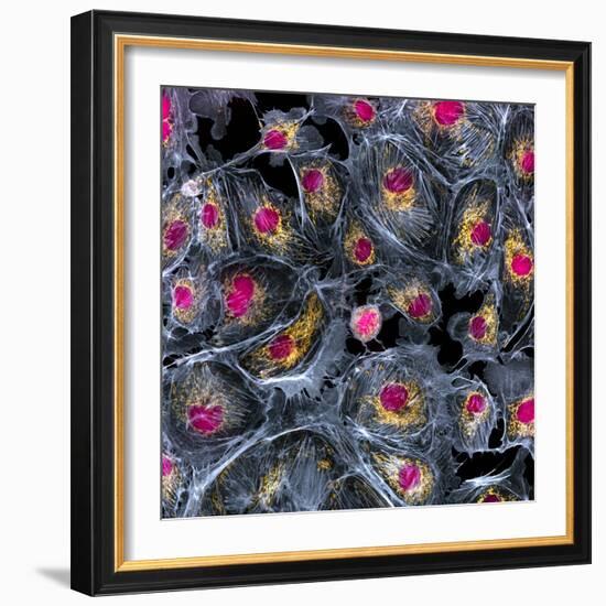 Lung Cells, Fluorescent Micrograph-Dr. Torsten Wittmann-Framed Premium Photographic Print