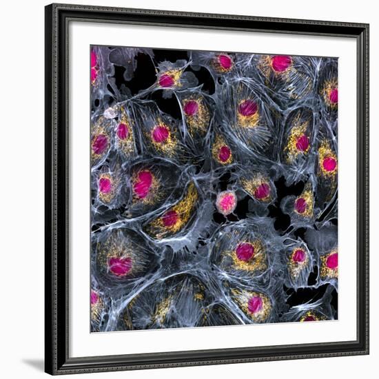 Lung Cells, Fluorescent Micrograph-Dr. Torsten Wittmann-Framed Photographic Print