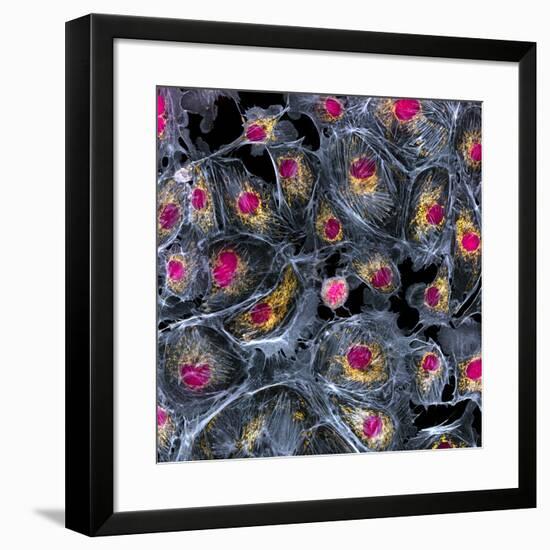 Lung Cells, Fluorescent Micrograph-Dr. Torsten Wittmann-Framed Photographic Print