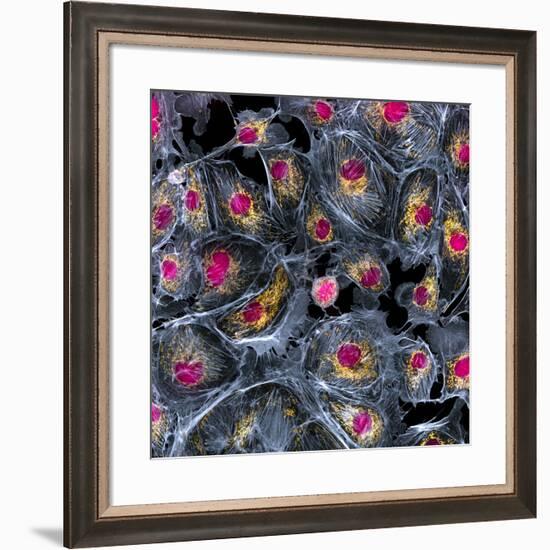 Lung Cells, Fluorescent Micrograph-Dr. Torsten Wittmann-Framed Photographic Print