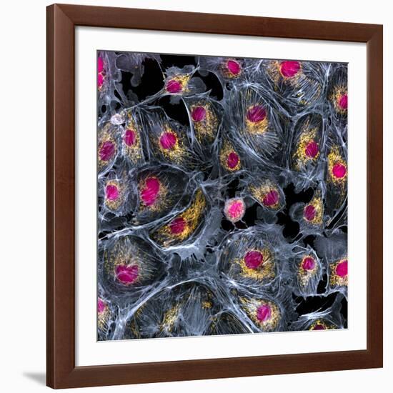 Lung Cells, Fluorescent Micrograph-Dr. Torsten Wittmann-Framed Photographic Print