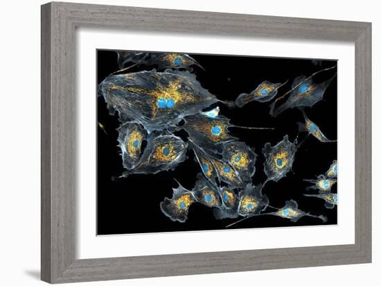 Lung Cells, Fluorescent Micrograph-Dr. Torsten Wittmann-Framed Photographic Print