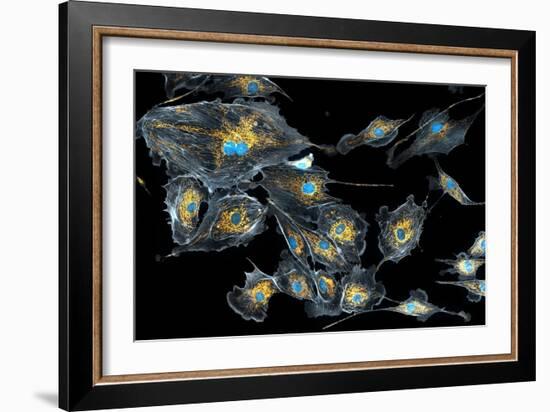 Lung Cells, Fluorescent Micrograph-Dr. Torsten Wittmann-Framed Photographic Print