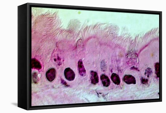 Lung Cells, Light Micrograph-Science Photo Library-Framed Premier Image Canvas