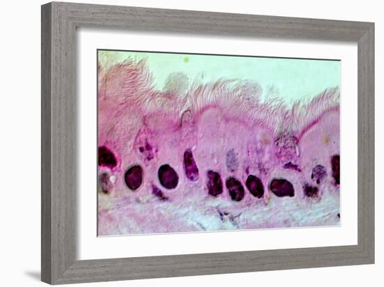 Lung Cells, Light Micrograph-Science Photo Library-Framed Photographic Print