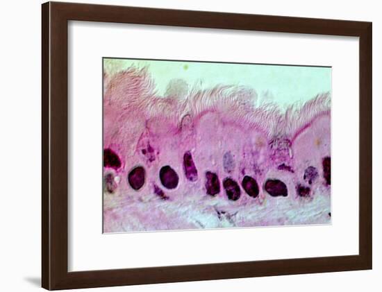 Lung Cells, Light Micrograph-Science Photo Library-Framed Photographic Print