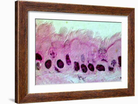 Lung Cells, Light Micrograph-Science Photo Library-Framed Photographic Print