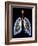 Lungs And Bronchial Tree, Artwork-PASIEKA-Framed Photographic Print