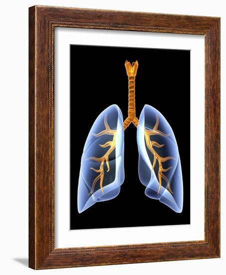 Lungs And Bronchial Tree, Artwork-PASIEKA-Framed Photographic Print