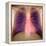 Lungs And Heart, X-ray-Du Cane Medical-Framed Premier Image Canvas