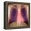 Lungs And Heart, X-ray-Du Cane Medical-Framed Premier Image Canvas