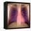 Lungs And Heart, X-ray-Du Cane Medical-Framed Premier Image Canvas